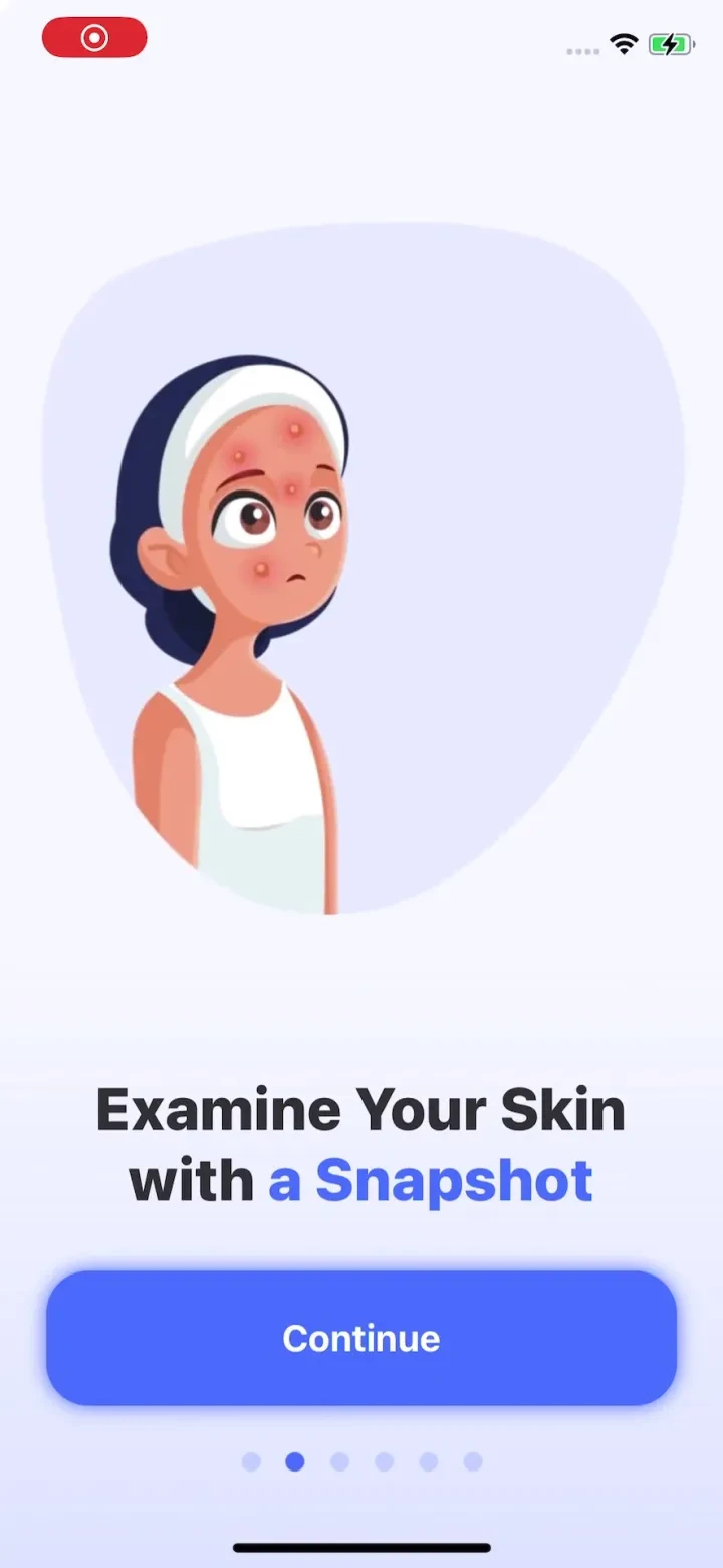 AI Skin Scanner - SkinGuru screenshot 4